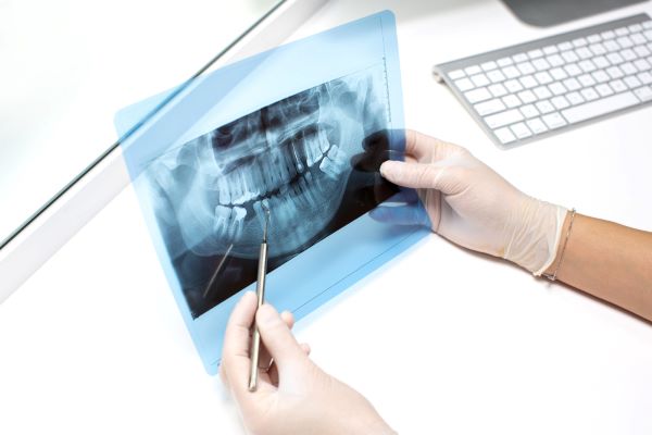 Röntgendiagnostik bei dem Kieferchirurgen