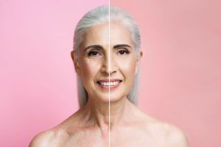 Was kann mit dem Facelifting in München erreicht werden?