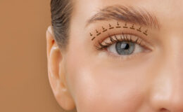 Die Oberlidstraffung - nur ein Trend oder steckt mehr dahinter?